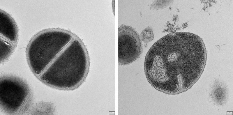 Staphylococcus bacteria that can cause human infections leading to immune failure. Left: A culture of the untreated bacteria. Right: A bacterial cell that has been destroyed by an antimicrobial peptide produced by the proteasome and discovered in the new study