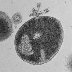 Staphylococcus bacteria that can cause human infections leading to immune failure. Left: A culture of the untreated bacteria. Right: A bacterial cell that has been destroyed by an antimicrobial peptide produced by the proteasome and discovered in the new study