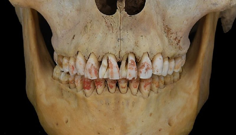 Cinnabar-stained teeth of the Red Princess of the Silk Road
