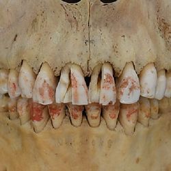 Cinnabar-stained teeth of the Red Princess of the Silk Road