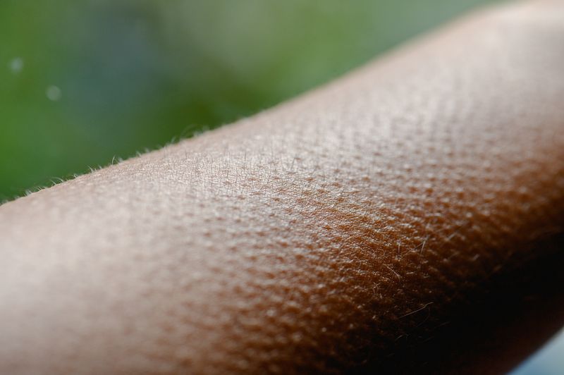 close-up photograph of goosebumps on an arm