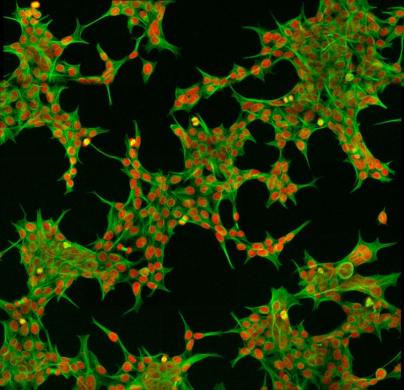  Immunofluorescent Human Embryonic Kidney 293 cells. Phospho-Histone H3 (yellow), phalloidin (green), nuclei (red)