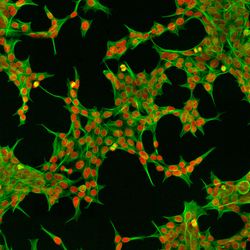  Immunofluorescent Human Embryonic Kidney 293 cells. Phospho-Histone H3 (yellow), phalloidin (green), nuclei (red)
