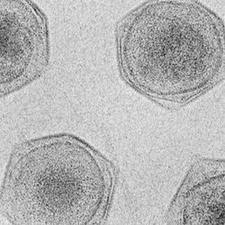 Cryo-electron micrograph of four CroV particles. They look like four hexagons with blobs contained within.