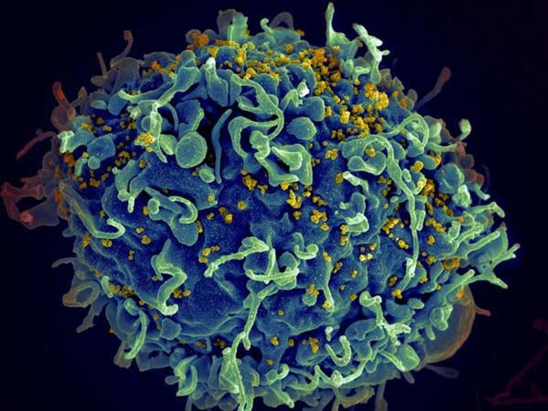 A scan image of a HIV infecting a cell. The cells is spherical and textured with small yellow dots scattered across it. 