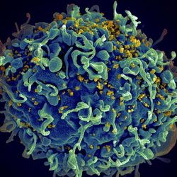 A scan image of a HIV infecting a cell. The cells is spherical and textured with small yellow dots scattered across it. 