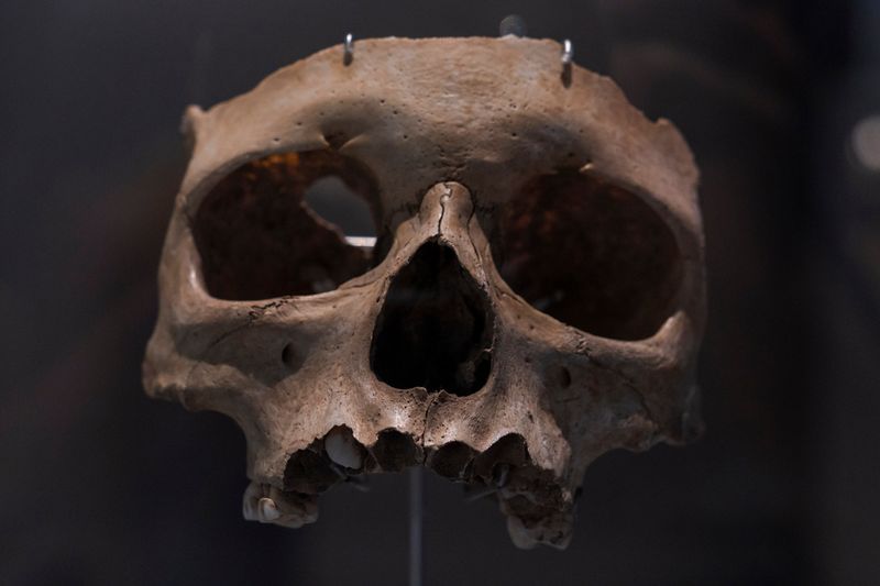 A photo of the front of a child's skull, showing only its upper jaw and the portion of the skull without the top of its head. 