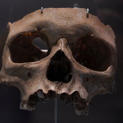 A photo of the front of a child's skull, showing only its upper jaw and the portion of the skull without the top of its head. 