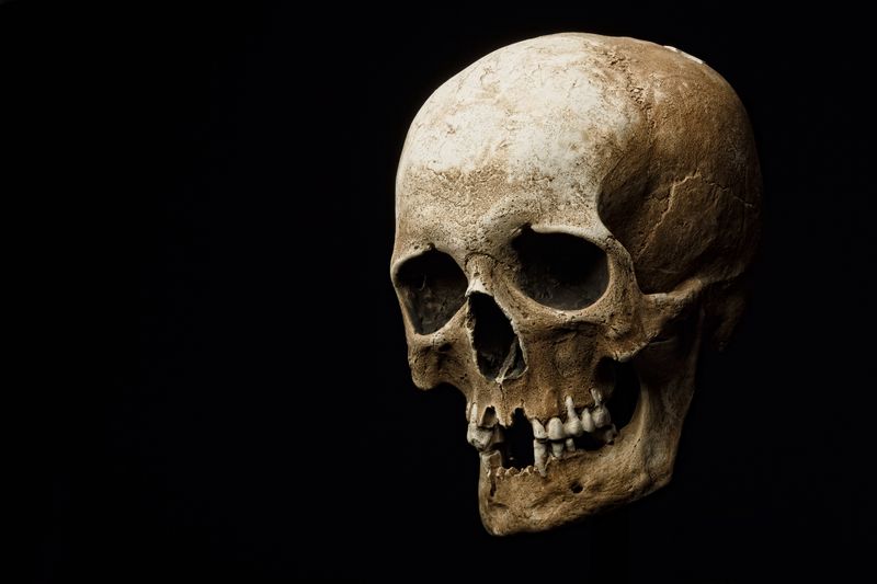 A human skull