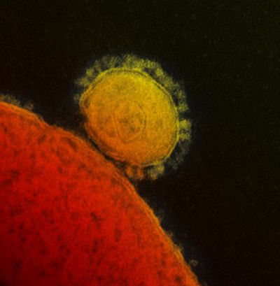 Electron micrograph of MERS virus particle (yellow) binding to a cell (orange)