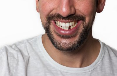 missing tooth