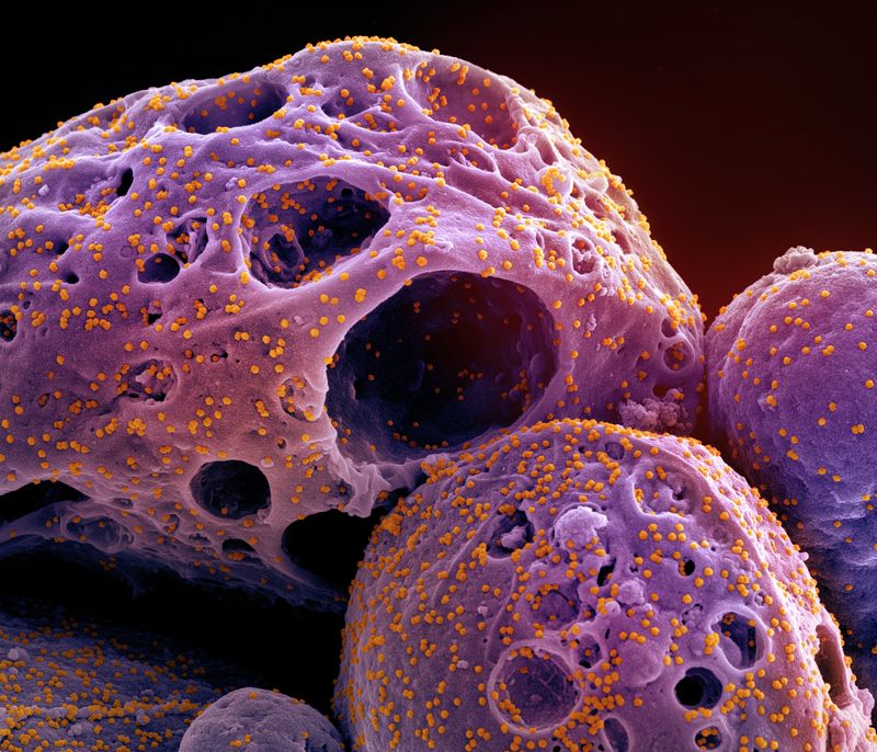 Scanning electron micrograph of a cell (purple) infected with the Omicron strain of SARS-CoV-2 virus particles (orange), isolated from a patient sample and colorized.