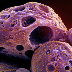 Scanning electron micrograph of a cell (purple) infected with the Omicron strain of SARS-CoV-2 virus particles (orange), isolated from a patient sample and colorized.