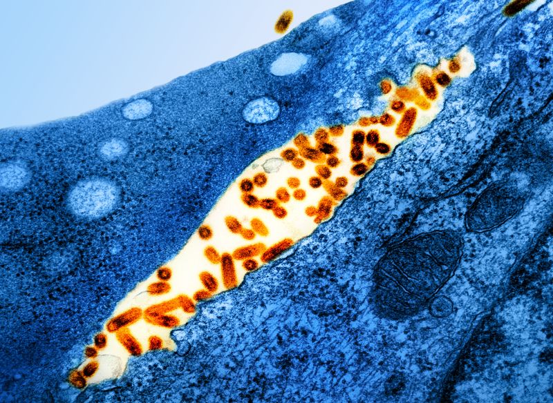 Transmission electron micrograph of vesicular stomatitis virus (VSV) particles (orange) found in extracellular space and budding from the plasma membrane of infected cells (blue). 