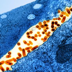 Transmission electron micrograph of vesicular stomatitis virus (VSV) particles (orange) found in extracellular space and budding from the plasma membrane of infected cells (blue). 
