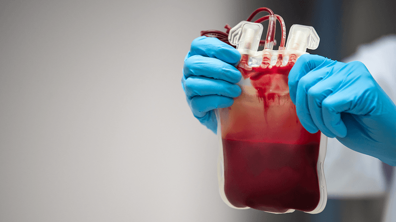 A bag of blood for transfusion.