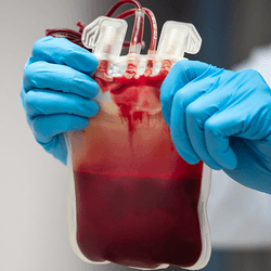 A bag of blood for transfusion.
