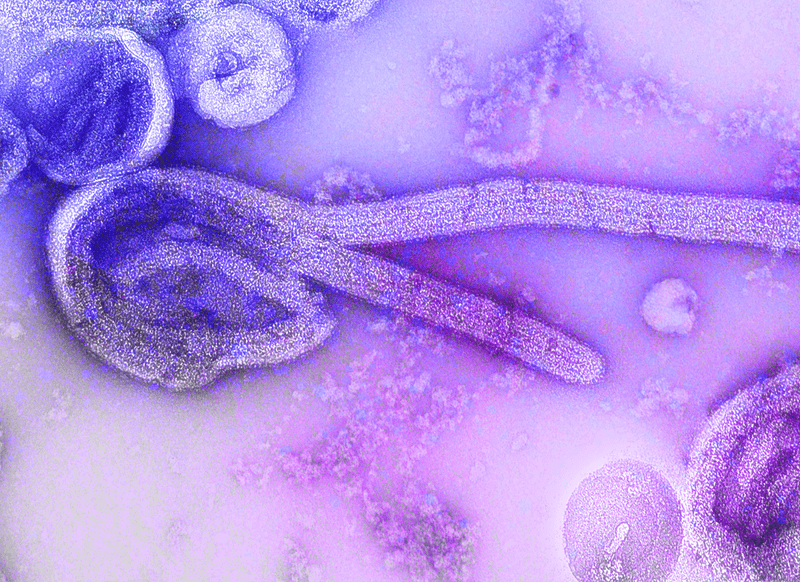 This is a digitally-colorized electron microscopic image of an isolate of Ebola virus. The internal structures of the filamentous particle are visible, including the nucleocapsid and other structural viral proteins, and the outer viral envelope is covered with surface projections.