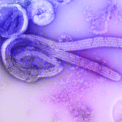 This is a digitally-colorized electron microscopic image of an isolate of Ebola virus. The internal structures of the filamentous particle are visible, including the nucleocapsid and other structural viral proteins, and the outer viral envelope is covered with surface projections.