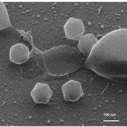 Two images showing the giant virus. The one on the left is a black and white microscope image of the virus, showing five of the virus particles which have hexagonal shapes surrounding a larger blog. Next to this is a digital reconstruction of the virus showing its shape as well as a cross section of its interior. 