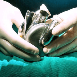 close up photograph of a surgeon's gloved hands holding a BiVACOR® Total Artificial Heart, which is made out of titanium