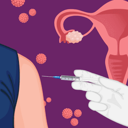 collage representing HPV vaccines and their impact on cervical cancer