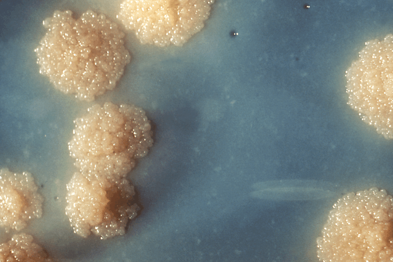 colonies of mycobacterium tuberculosis that have been grown on an unidentified culture medium in a Petri dish; the bacterial colonies appear as large beige blobs 