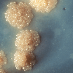 colonies of mycobacterium tuberculosis that have been grown on an unidentified culture medium in a Petri dish; the bacterial colonies appear as large beige blobs 