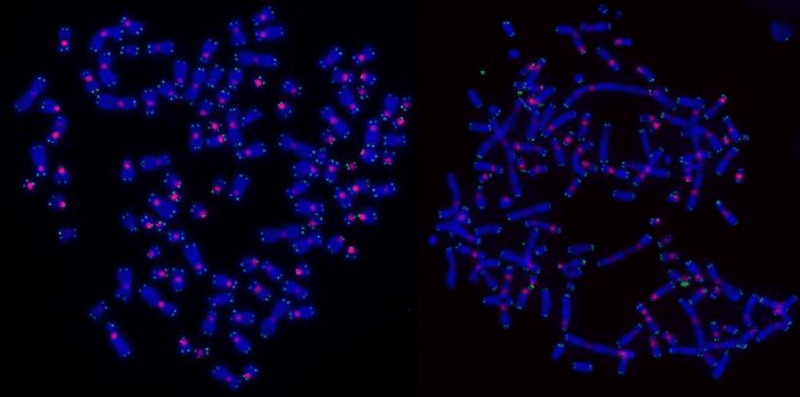 Chromosomes from cancer cells with DNA stained to look blue, telomeres green, and centromeres pink