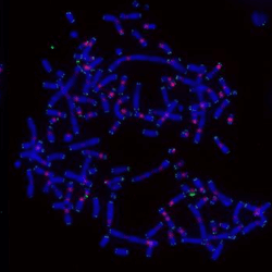 Chromosomes from cancer cells with DNA stained to look blue, telomeres green, and centromeres pink