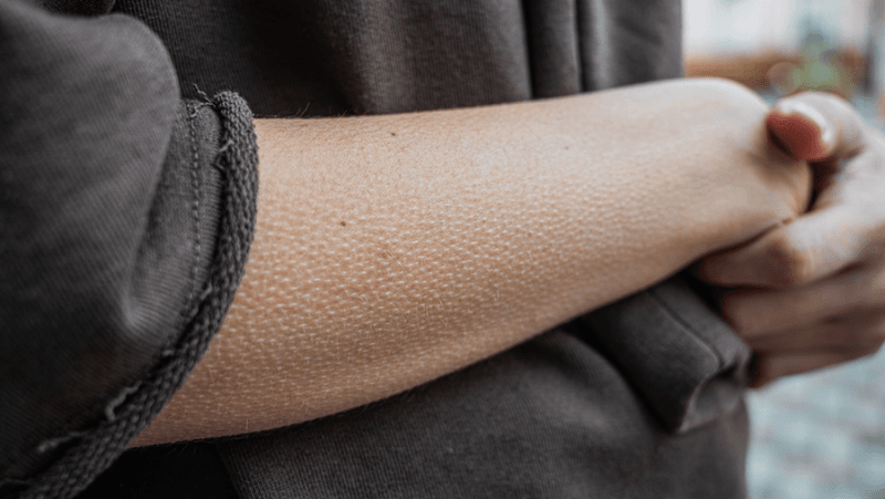 a human arm with little bumps from cold they are goosebumps a vestigial reflex